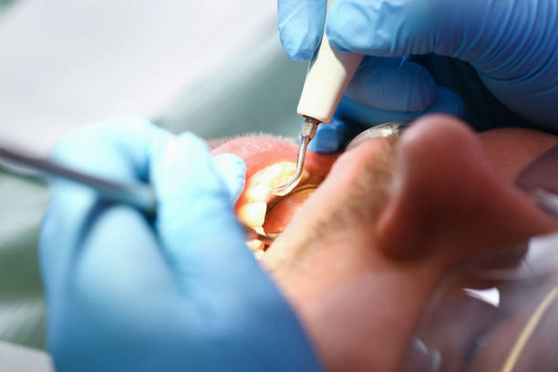 Best Dentist for Severe Toothache  in Burr Ridge, IL