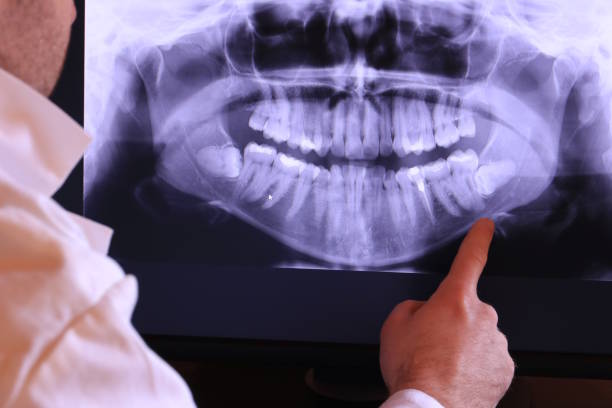 Best Tooth Infection Emergency Dentist  in Burr Ridge, IL