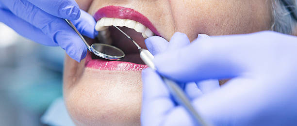 Best Dentist for Tooth Abscess  in Burr Ridge, IL